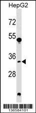 Anti-SRM (Center) Antibody