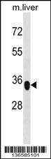 Anti-YIPF3 (C-term) Antibody