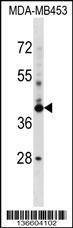 Anti-SRRD (Center) Antibody