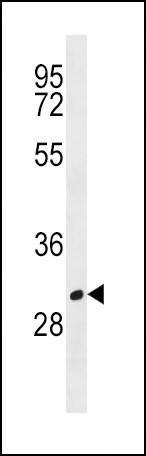 Anti-MS4A1 (C-term) Antibody
