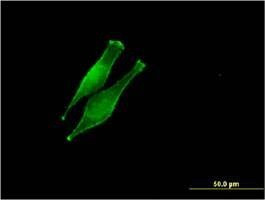 Anti-DDOST Antibody