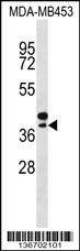 Anti-SEPP1 (Center) Antibody