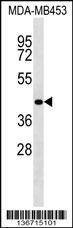 Anti-RBM4 (C-term) Antibody