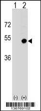 Anti-CD1D (Center) Antibody