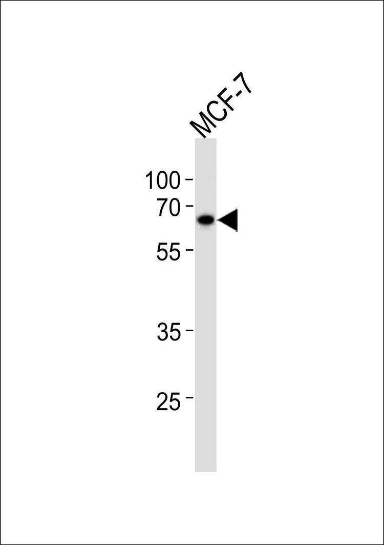 Anti-ESR2 (Center) Antibody