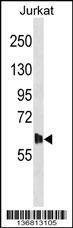 Anti-DMPK (N-term) Antibody