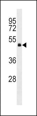 Anti-GNA13 (Center) Antibody