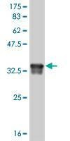 Anti-DEAF1 Antibody