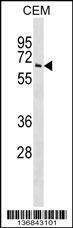 Anti-TPP1 (N-term) Antibody