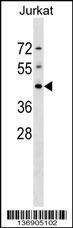 Anti-DHPS (N-term) Antibody