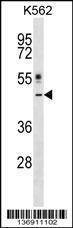 Anti-CRLF1 (Center) Antibody