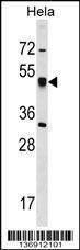 Anti-CRTAP (N-term) Antibody