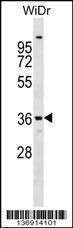 Anti-ANXA9 (Center) Antibody