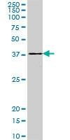 Anti-DEGS1 Antibody