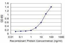 Anti-DEGS1 Antibody