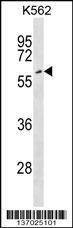 Anti-EYA2 (Center) Antibody