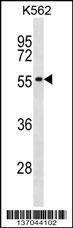 Anti-POLR1E (Center) Antibody