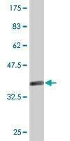 Anti-DFFA Antibody