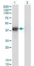 Anti-DFFA Antibody