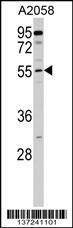 Anti-CNDP2 (C-term) Antibody