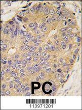 Anti-BMP15 (Center) Antibody