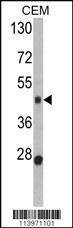 Anti-BMP15 (Center) Antibody
