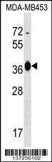 Anti-GFOD2 (N-term) Antibody