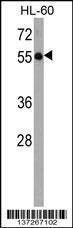 Anti-KLHL3 (Center) Antibody