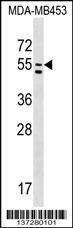 Anti-PTDSS1 (C-term) Antibody