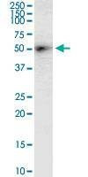 Anti-DGAT2 Antibody