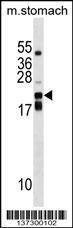 Anti-CDC42EP2 (C-term) Antibody
