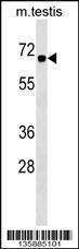 Anti-CBX2 (Center) Antibody