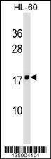 Anti-ND4L (C-term) Antibody