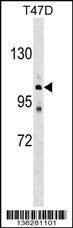 Anti-ATP2C1 (C-term) Antibody