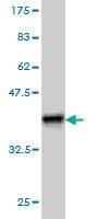 Anti-DHODH Antibody