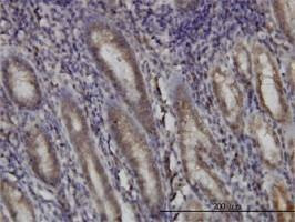 Anti-DHODH Antibody