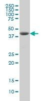 Anti-DHODH Antibody