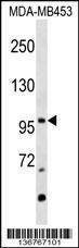 Anti-NR3C2 (Center) Antibody