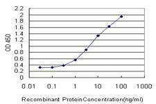Anti-DHX8 Antibody