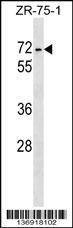 Anti-ZKSCAN1 (Center) Antibody