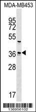 Anti-UBE2Z (C-term) Antibody