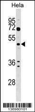 Anti-ALG2 (Center) Antibody