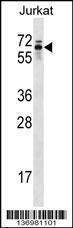Anti-TROVE2 (C-term) Antibody