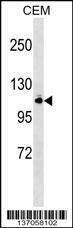 Anti-GRIK5 (N-term) Antibody