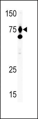 Anti-HGF (C-term) Antibody