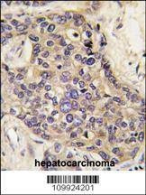 Anti-HGF (C-term) Antibody