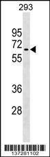 Anti-RNF168 (C-term) Antibody