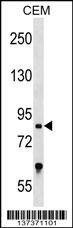 Anti-TCF25 (N-term) Antibody