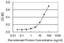 Anti-DIP2A Antibody