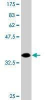 Anti-DIP2A Antibody